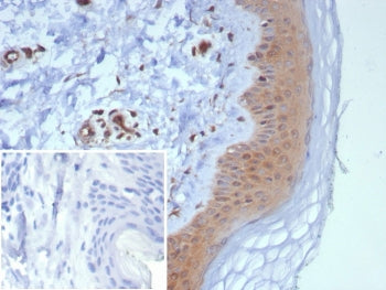 IHC staining of FFPE human skin tissue with NME2 antibody (clone NME2/6433). Inset: PBS used in plac