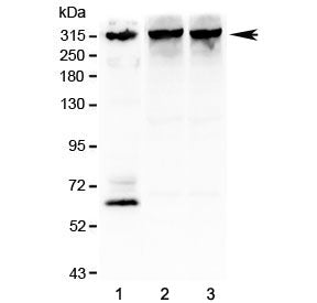 Western blot testing of 1) human SHG-44 (glioma), 2) rat brain and 3) mouse brain lysate with IP3R a