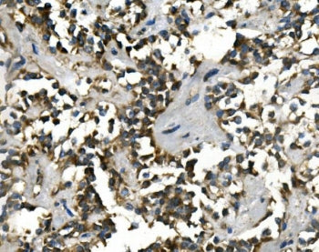 VMAT1 Antibody / SLC18A1