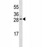 EPO Antibody