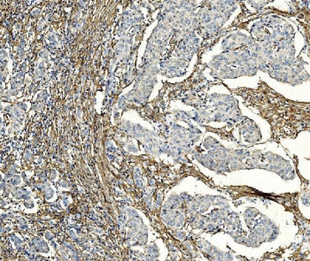 PAR1 Antibody / F2R / Thrombin Receptor