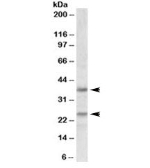 Podoplanin Antibody