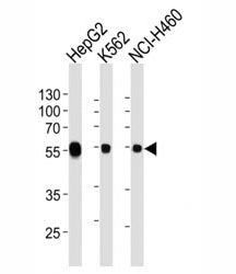 ALDH1A1 Antibody