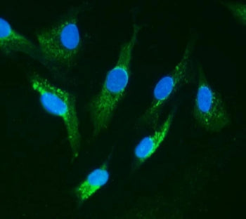IRAK1 Antibody