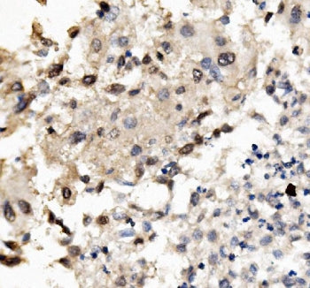 MNT Antibody / Max-binding protein MNT