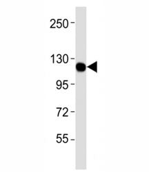 Western blot testing of CSF1R antibodyat 1:4000 dilution + U-87MG lysate; Predicted molecular weight