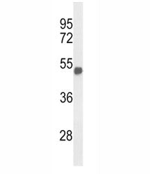 Western blot analysis of FOXG1 antibody and mouse brain tissue lysate. Predicted molecular weight: 5