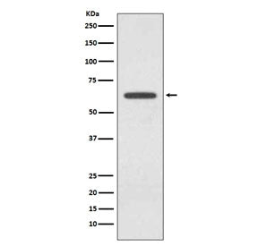 Glutaminase Antibody / GLS