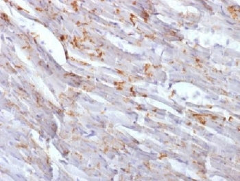 IHC testing of FFPE mouse heart with Cadherin 2 antibody (clone CDH2/1573). Required HIER: boil tiss
