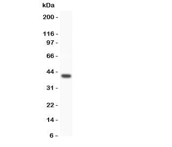 Western blot testing of WNT3A antibody and SMMC-7721 lysate. Expected/observed size 35~44KD dependin