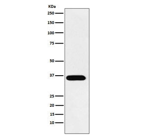 Western blot testing of human A431 cell lysate with ACP5 antibody. Predicted molecular weight ~36 kD