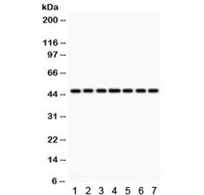 Western blot testing of 1) rat lung, 2) rat kidney, 3) rat brain, 4) human HeLa, 5) SMMC, 6) A549 an