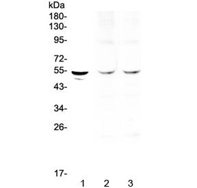 TPH1 Antibody / Tryptophan Hydroxylase