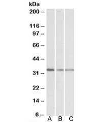 Western blot testing of human lymph node [A], mouse spleen [B] and rat spleen [C] lysates with GNB2L
