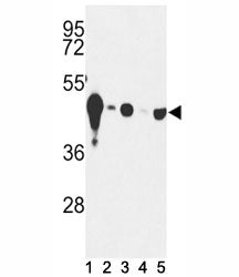 NSE Antibody