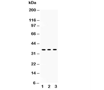 Western blot testing of SIRT6 antibody and Lane 1: HeLa; 2: A549; 3: human placenta lysate
