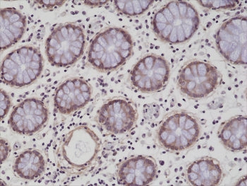 Integrin beta 1 Antibody / ITGB1 / CD29