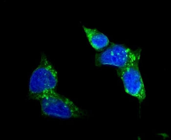 Immunofluorescent staining of FFPE human HepG2 cells with SLC2A1 antibody (green) and DAPI nuclear s