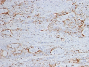 IHC staining of FFPE human colon with CD151 antibody (clone 11G5a). HIER: boil tissue sections in pH