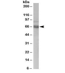 ATR Antibody