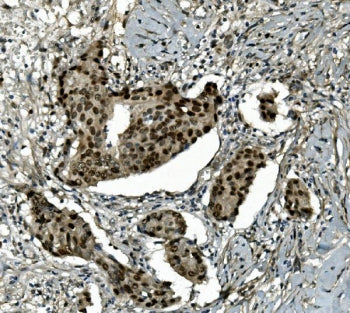 TKT Antibody / Transketolase