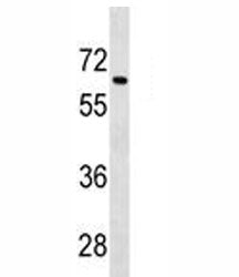 Tgfbr2 Antibody