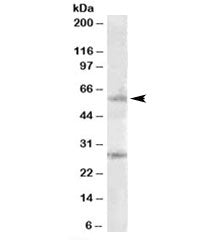 Western blot testing of Daudi lysate with SOCS7 antibody at 1ug/ml. The expected ~60kDa band and the