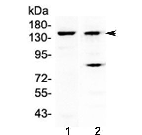 KDM2A Antibody / FBXL11