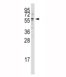 Tip60 Antibody