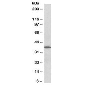 AIMP1 Antibody / EMAP II (Biotin Conjugate)