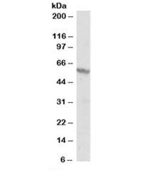 Western blot testing of A431 lysate and RXR beta antibody at 1ug/ml. Predicted molecular weight: ~57