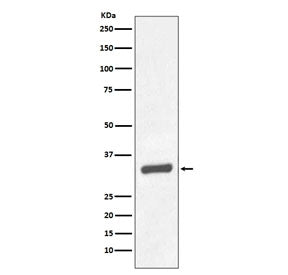 Western blot testing of human prostate carcinoma tissue lysate with PSA antibody. Predicted molecula