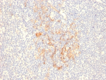 IHC staining of FFPE human tonsil with CD79b antibody (clone IGB/2555). HIER: boil tissue sections i
