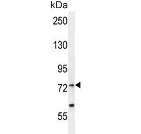 Arginyl-tRNA synthetase Antibody (cytoplasmic) / RARS1