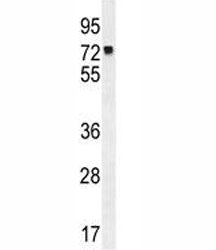 MLH1 antibody western blot analysis in K562 lysate. Predicted molecular weight: 85/58/74 kDa (isofor