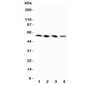 Western blot testing of RIP3 antibody and Lane 1: PANC; 2: SW620; 3: SKOV-3; 4: M231 cell lysate