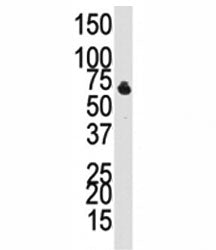 BMPR1B Antibody