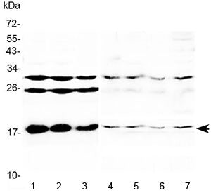 Western blot testing of 1) mouse liver, 2) mouse kidney, 3) mouse testis, 4) rat heart, 5) rat liver