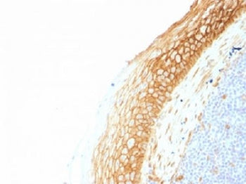 IHC testing of FFPE human tonsil tissue with Beta Catenin antibody (clone CTNNB1/1507). Required HIE