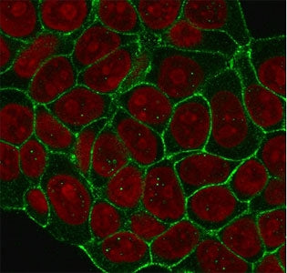 HER2 Antibody / ErbB2