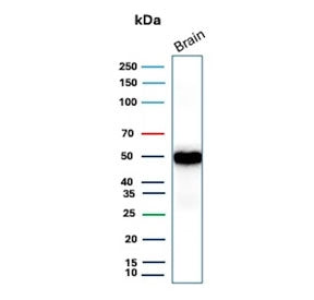 GFAP Antibody / Glial Fibrillary Acidic Protein