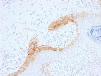 KRT15 Antibody / Cytokeratin 15