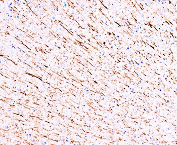 MAP1 Antibody