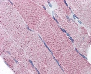 PCSK6 Antibody