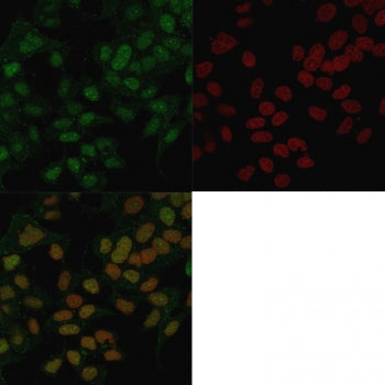 Immunofluorescent staining of PFA-fixed human MCF7 cells with FOXA1 antibody (clone FOXA1/1241, gree