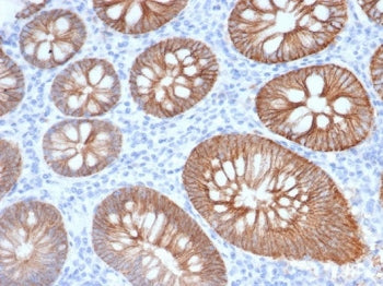 S100A14 Antibody
