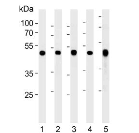 ENO1 Antibody / Enolase 1 / Alpha Enolase