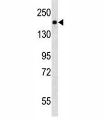 Platelet Derived Growth Factor Receptor beta Antibody (PDGFRB)