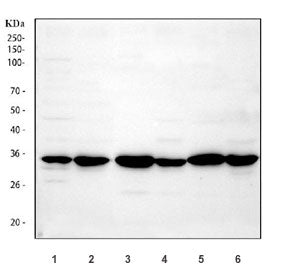 Western blot testing of 1) human U-87 MG, 2) human U-251, 3) rat brain, 4) rat C6, 5) mouse brain an