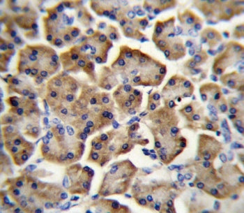BTC Antibody / Betacellulin